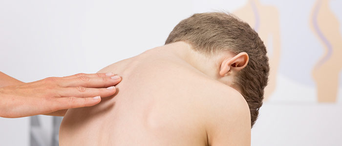 Chiropractic Care for Scoliosis Chiropractic Care for Scoliosis